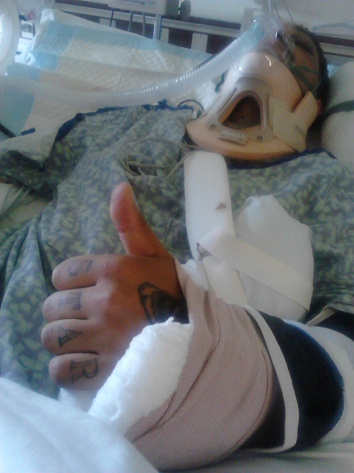 Aaron Hartmann gives a thumbs up from his hospital bed to let friends know he’s doing OK. (Credit: Bobby Hartmann file)